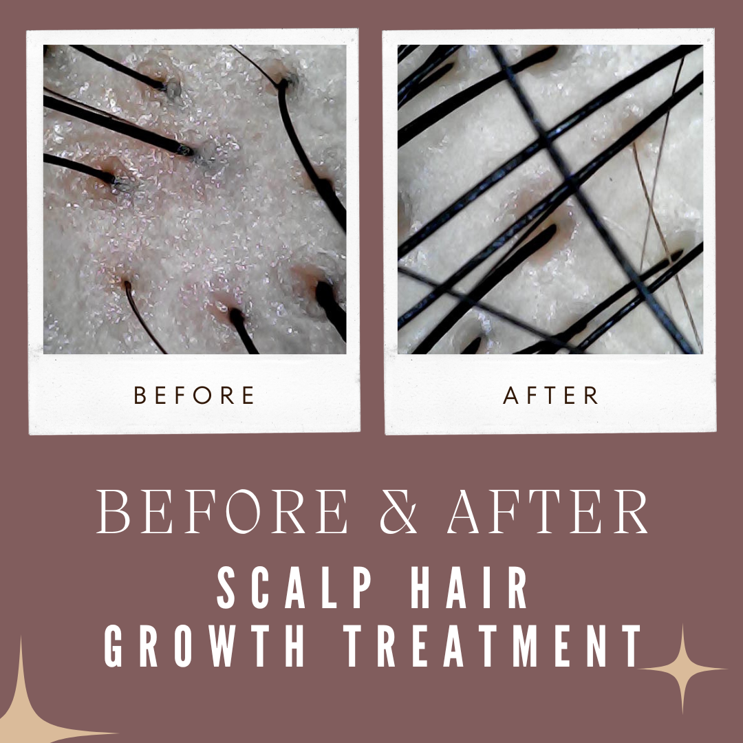 施術前後の画像